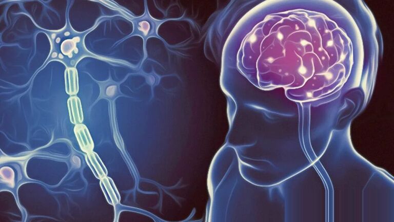 ام‌اس چیست و چه درمانی دارد؟