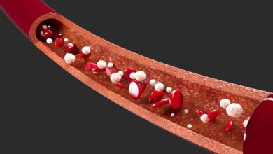 پایش لحظه‌ای غلظت دارو در خون با حسگر نانویی ممکن شد