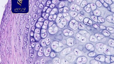 بهبود روش انتقال سلول بنیادی برای ترمیم بافت غضروف