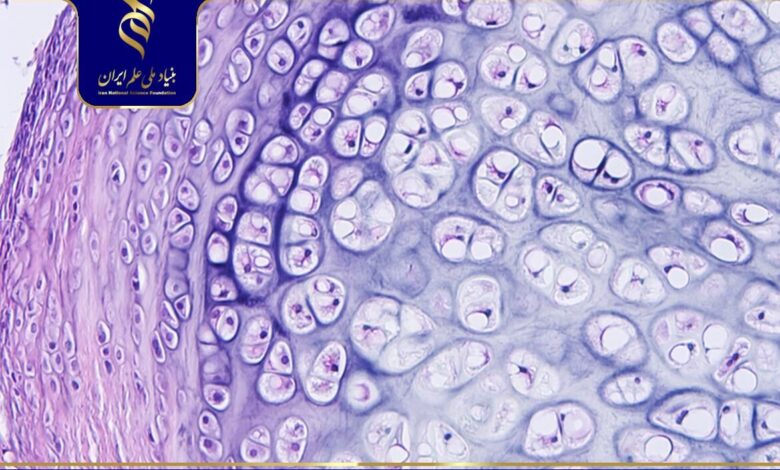 بهبود روش انتقال سلول بنیادی برای ترمیم بافت غضروف