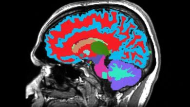 ساخت ابزار اندازه‌گیری سرعت پیری و پیش‌بینی زوال عقل