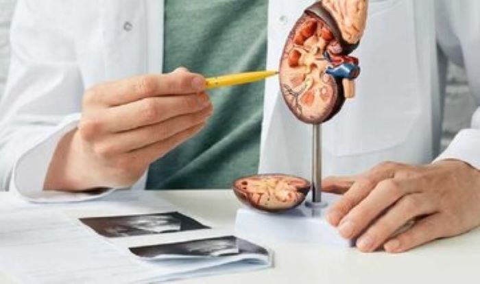 سنگ کلیه؛ علائم، درمان و باورهای غلط