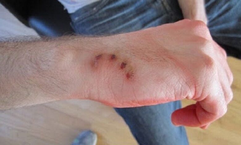 ۸۰ درصد بیماری‌ها از حیوان به انسان منتقل می‌شود/ ۲۴ میلیون یورو هزینه سالانه واکسن هاری