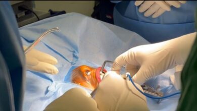 جراحی موفق تومور قاعده جمجمه از راه دهان