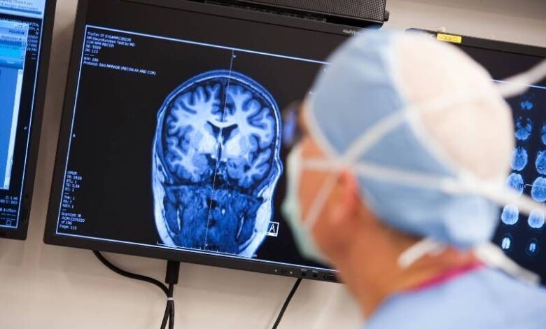 تشخیص بیماری‌های مغزی با ارتقای تصویربرداری ام آر آی توسط هوش مصنوعی 