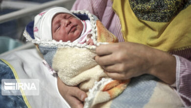 وزارت بهداشت: تغذیه مادر باردار نقشی در بروز زردی نوزاد ندارد