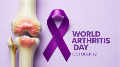 تحرک؛ درمان دردناک التهاب مفاصل