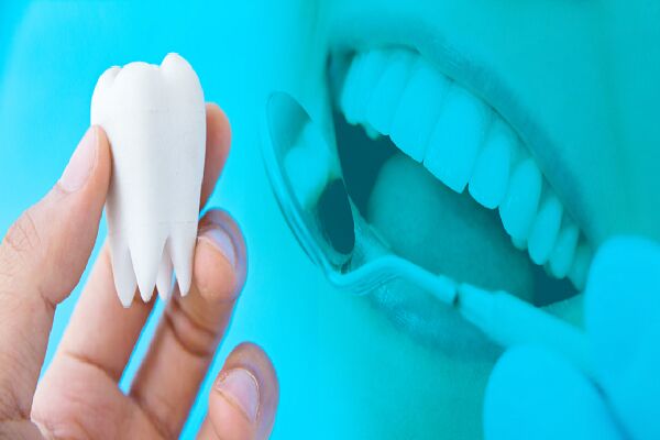 درخواست جامعه دندان‌سازان برای تعیین تکلیف آیین‌نامه لابراتواری دندان‌سازی