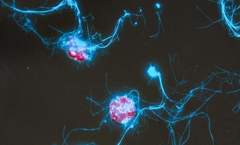 فیلم‌برداری از مهمانی میکروب‌ها در اقیانوس با کاوشگر مولکولی