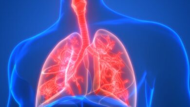 کاهش بروز سل در ایران به ۱۱ مورد در هر ۱۰۰ هزار نفر