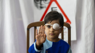 کاهش شیوع تنبلی چشم در کشور/انجام ۶۲ میلیون غربالگری بینایی