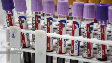 تفسیر نتایج آزمایش‌های پزشکی باید فقط توسط پزشکان انجام شود، نه هوش مصنوعی