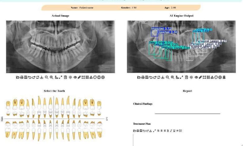 توسعه سامانه هوشمند تحلیل تصاویر دندانپزشکی در دانشگاه تهران