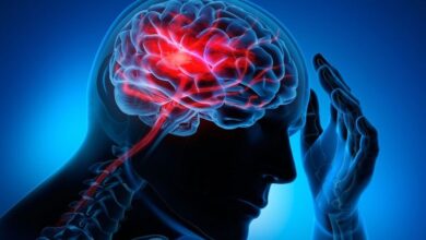 سکته مغزی دومین علت مرگ و میر در ایران است/ نرخ بروز در کشور ۱.۵ برابر نرم جهانی