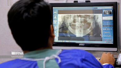 هوش مصنوعی مشاور دندانپزشکان است