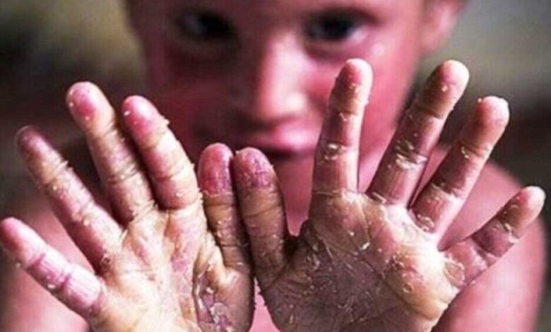 وقتی بال‌های پروانه شکست‌ناپذیر می‌شود