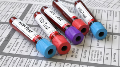 ۴۰ سال مبارزه با ایدز در ایران؛ از شکستن قید و بندهای عرفی تا درمانهای پیشرفته