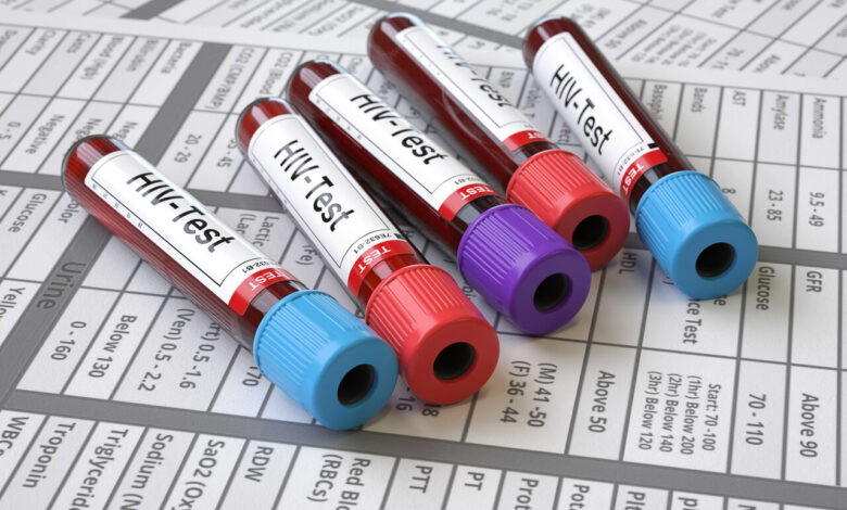 ۴۰ سال مبارزه با ایدز در ایران؛ از شکستن قید و بندهای عرفی تا درمانهای پیشرفته